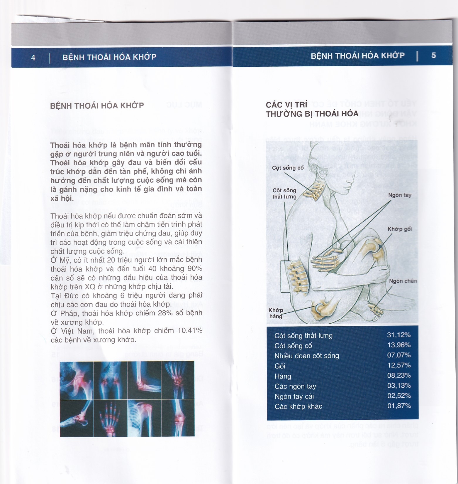 Hình ảnh Dung dịch Duo Vital 500ml Gramme Revit giảm đau nhức khớp, thoái hoá khớp