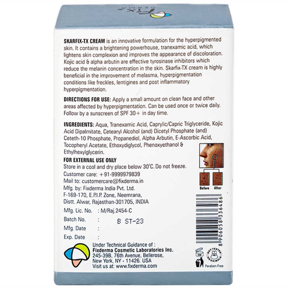 Hình ảnh Kem Fixderma Skarfix-TX Cream hỗ trợ làm mờ vết thâm, đốm đen, nám (30g)
