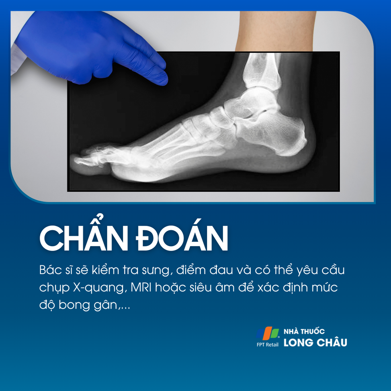 Bác sĩ kiểm tra, có thể chỉ định X-quang, MRI, siêu âm