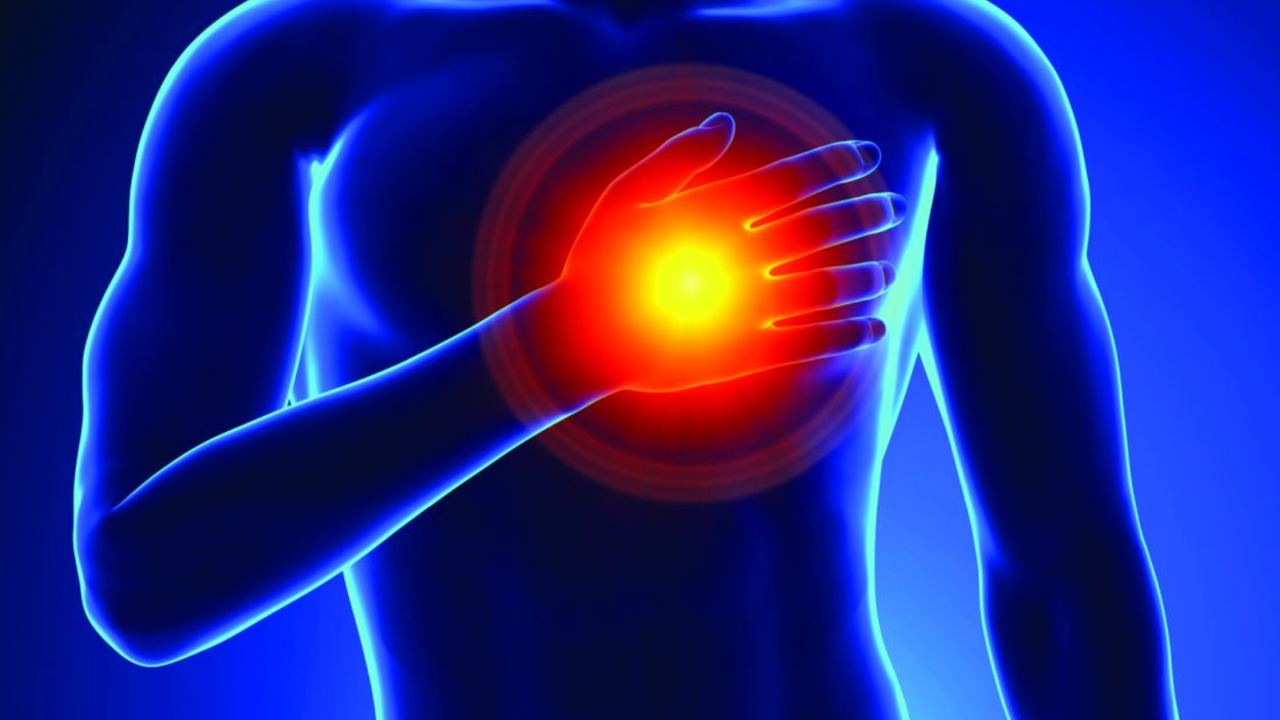 Nhồi máu cơ tim cấp là gì? Những điều cần biết về bệnh nhồi máu cơ tim cấp 1