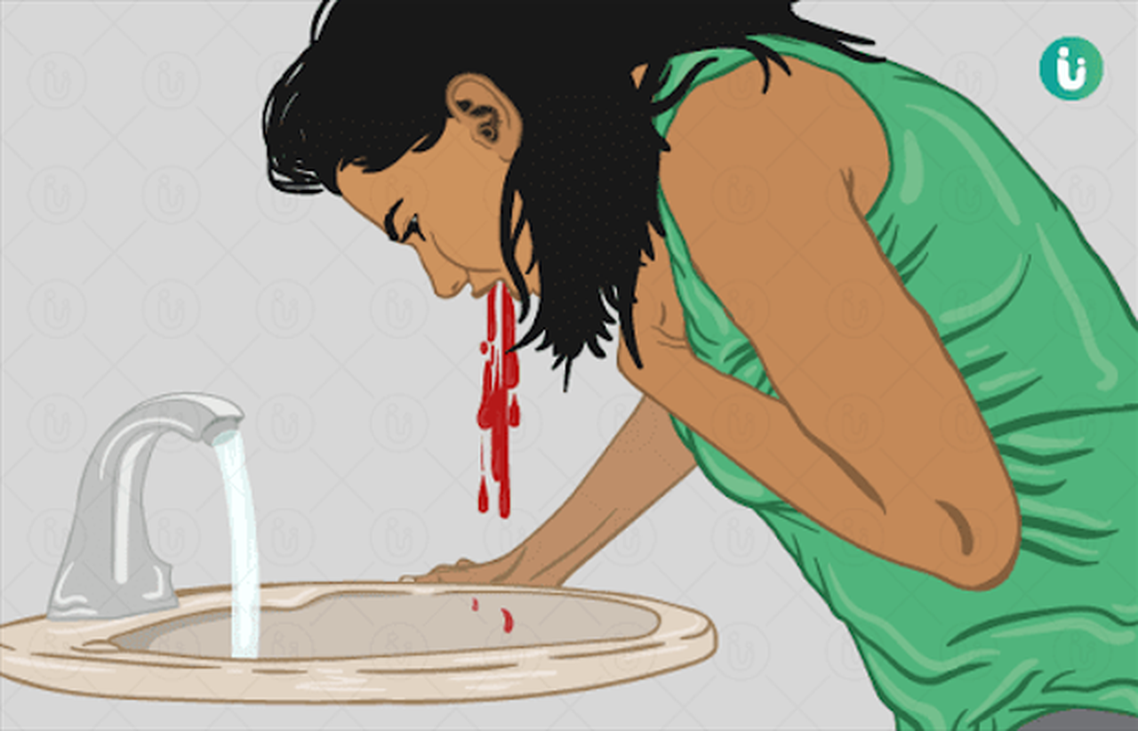 Nôn ra máu là gì? Nguyên nhân gây bệnh và nguyên tắc phòng ngừa