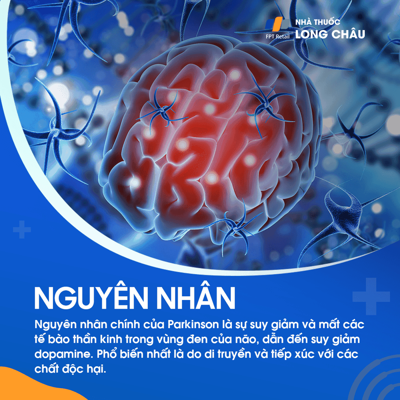 Nguyên nhân bệnh Parkinson - Các yếu tố gây rối loạn thần kinh và biện pháp phòng ngừa