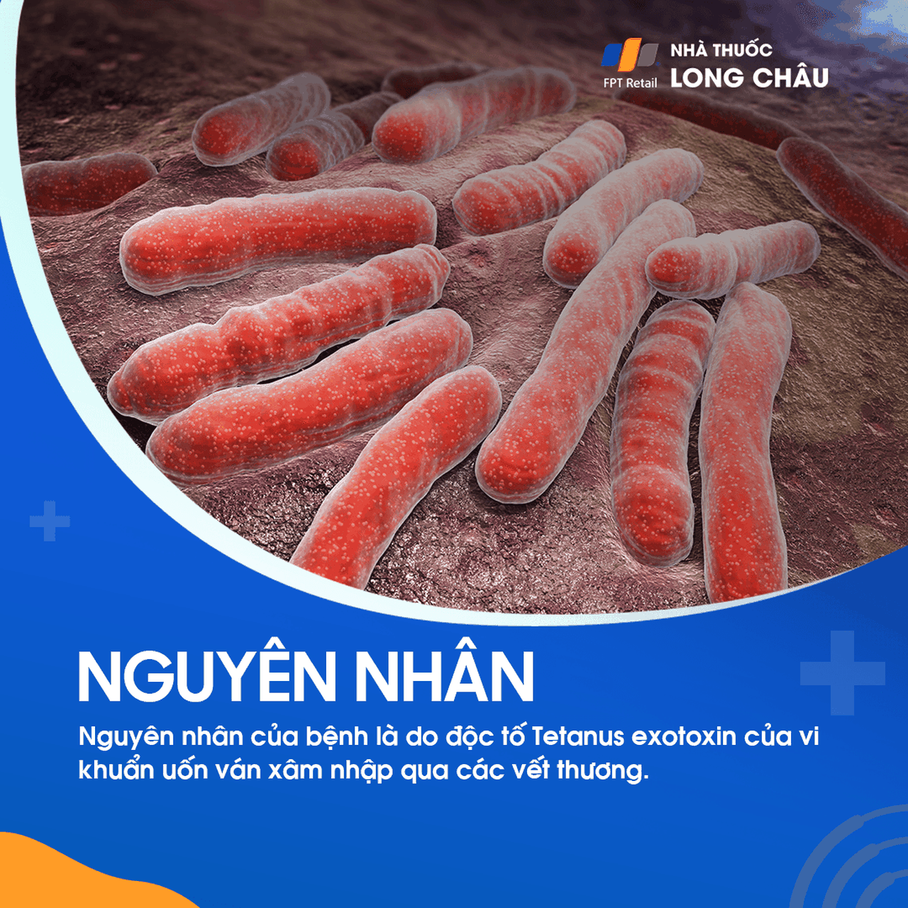 Vết thương bị nhiễm trùng Clostridium tetani, vi khuẩn gây ra bệnh uốn ván, thường xảy ra ở những vùng không sạch sẽ