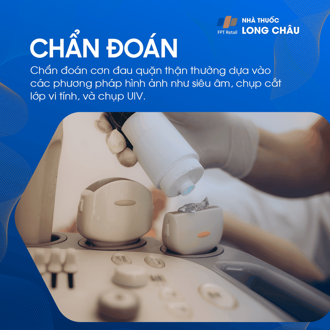 Chẩn đoán đau quặn thận - Quy trình kiểm tra và xác định nguyên nhân gây đau quặn thận
