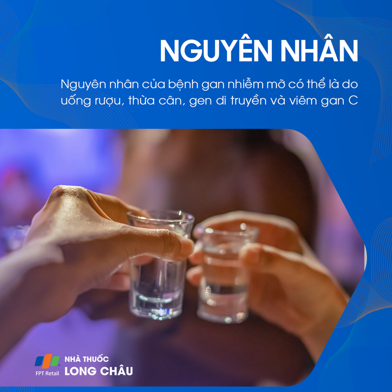Nguyên nhân gan nhiễm mỡ - Các yếu tố gây tích tụ mỡ trong gan