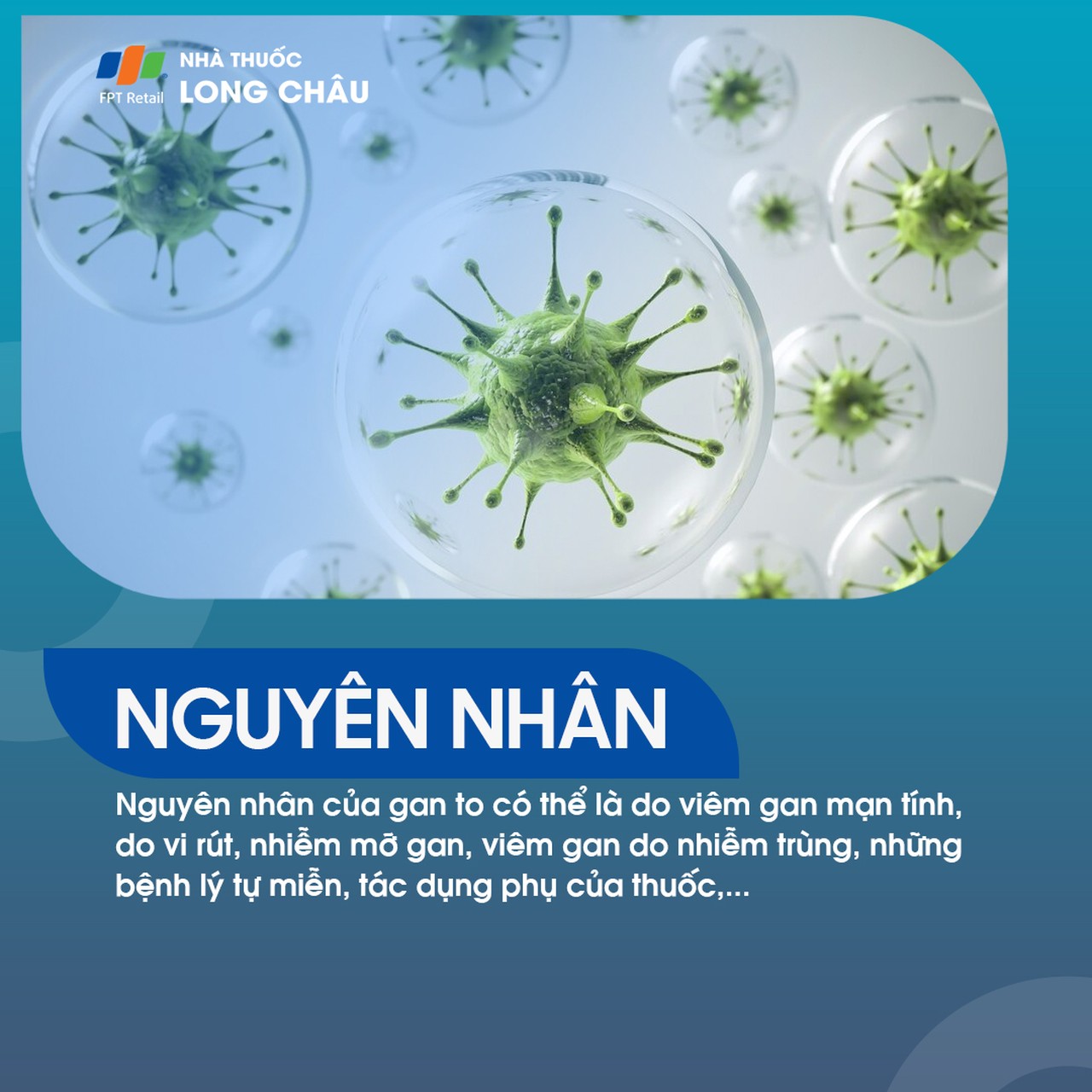 Nguyên nhân gan to - Các yếu tố gây phì đại gan và biện pháp phòng ngừa