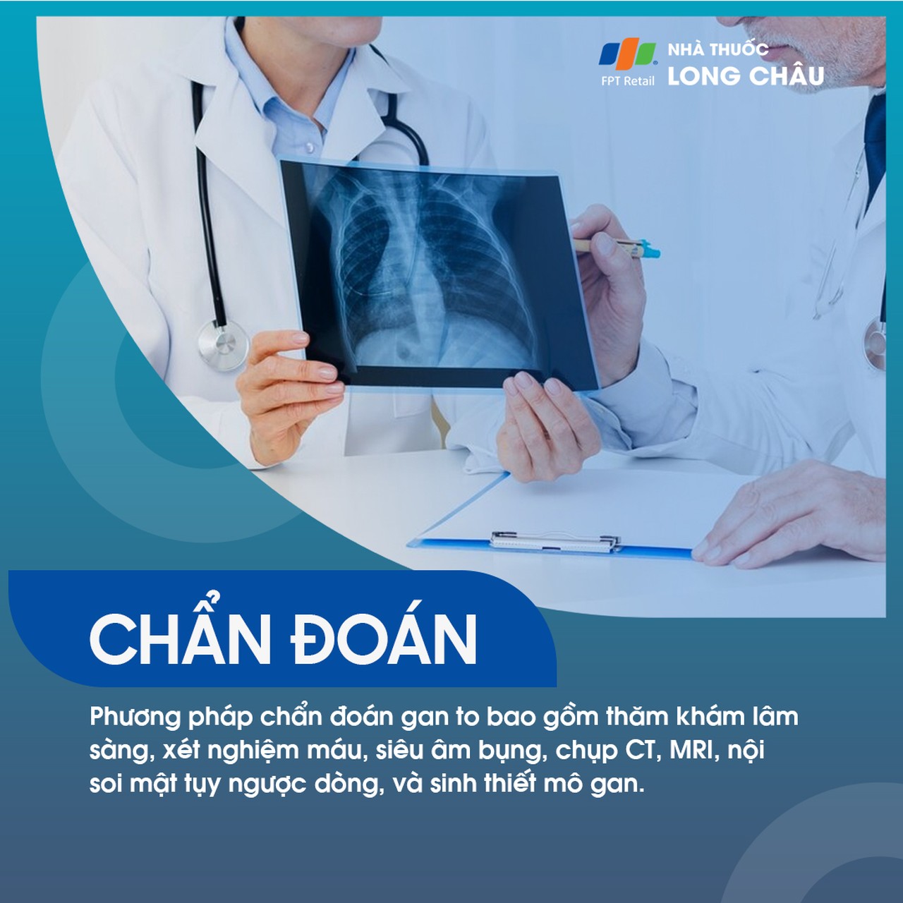 Phương pháp chẩn đoán bệnh Gan to