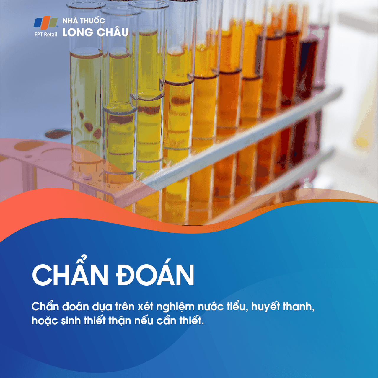 Chẩn đoán hội chứng thận hư - Quy trình kiểm tra và xác định bệnh lý thận hư