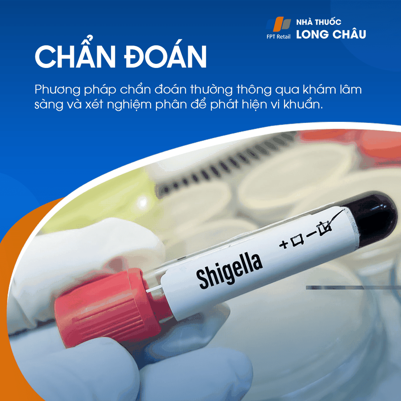 Lỵ trực trùng 5