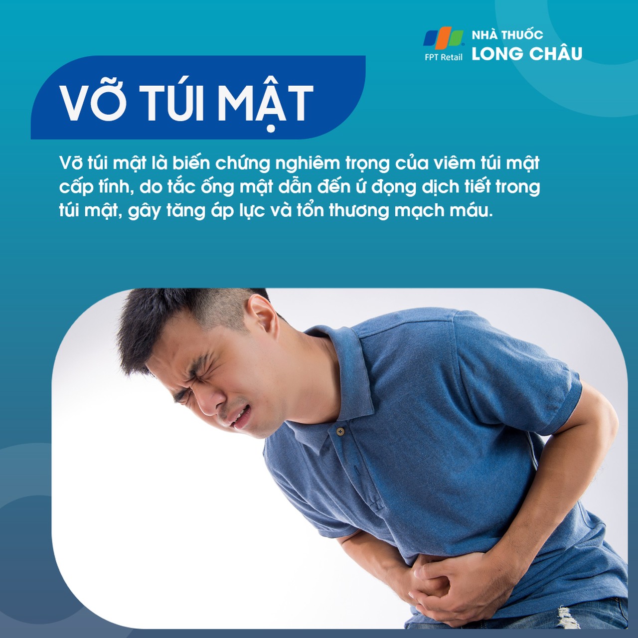 Vỡ túi mật (Gallbladder Perforation) là một biến chứng nghiêm trọng của viêm túi mật cấp tính.