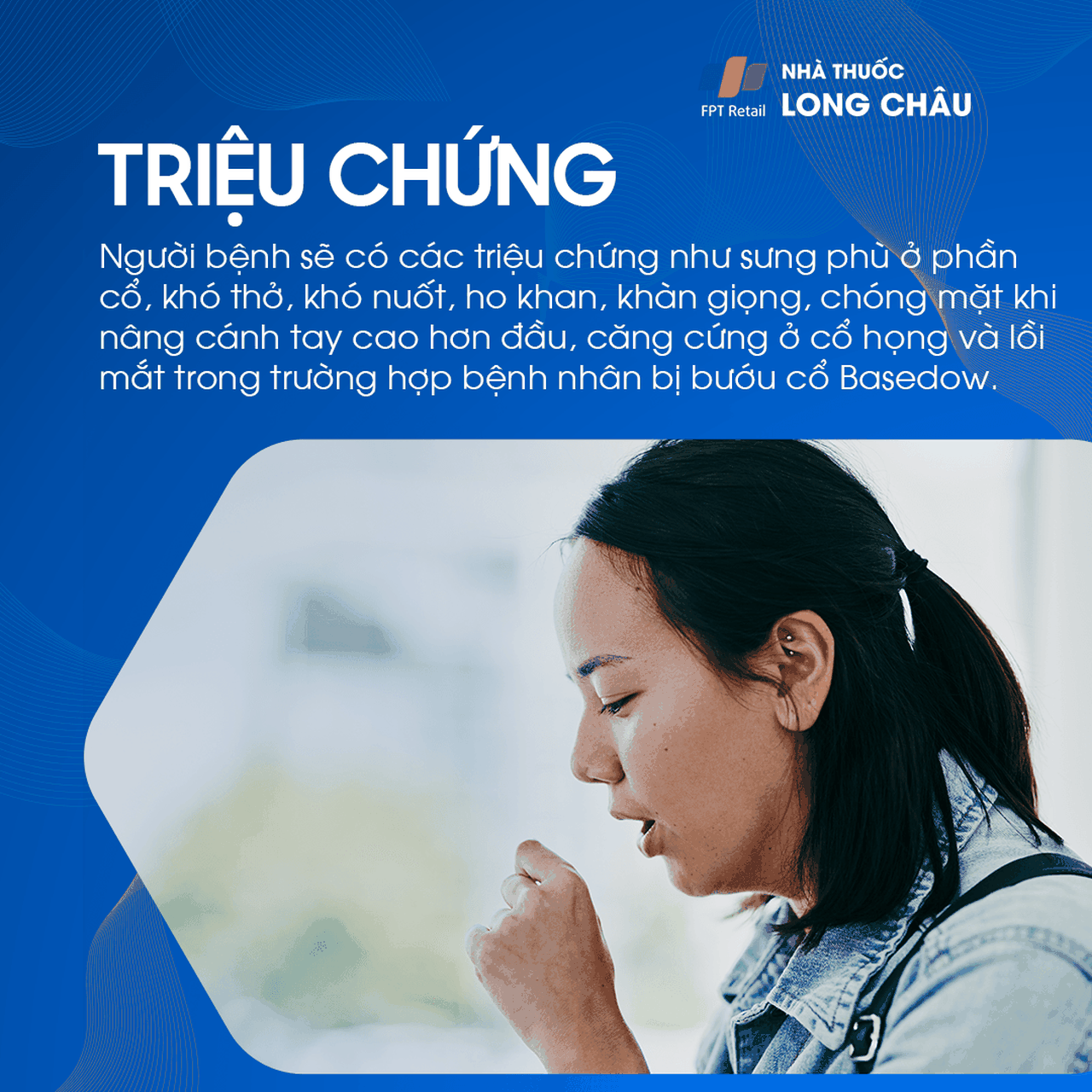Triệu chứng gồm: cổ sưng, khó thở, khó nuốt, ho, khàn giọng, chóng mặt, cổ họng căng, và mắt lồi