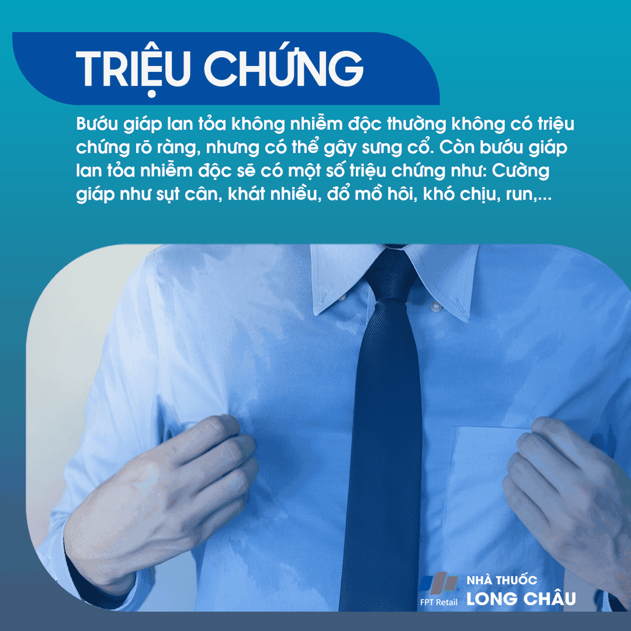 Bướu giáp lan tỏa 2