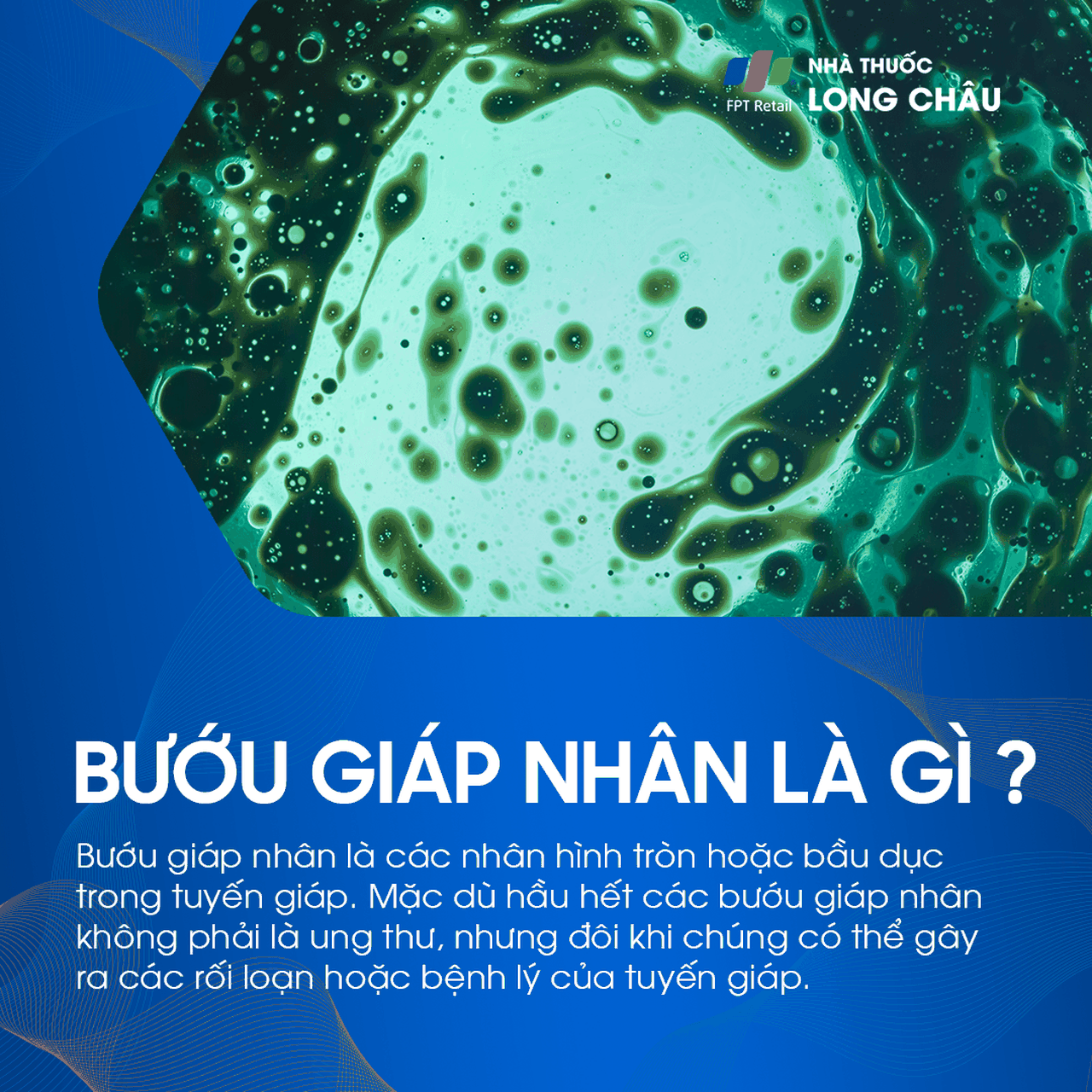 Bướu giáp nhân 1
