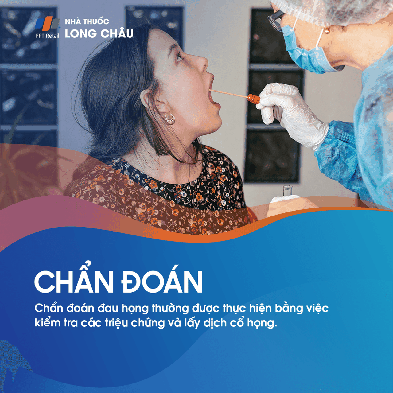 Chẩn đoán đau họng thường dựa trên triệu chứng và xét nghiệm dịch họng