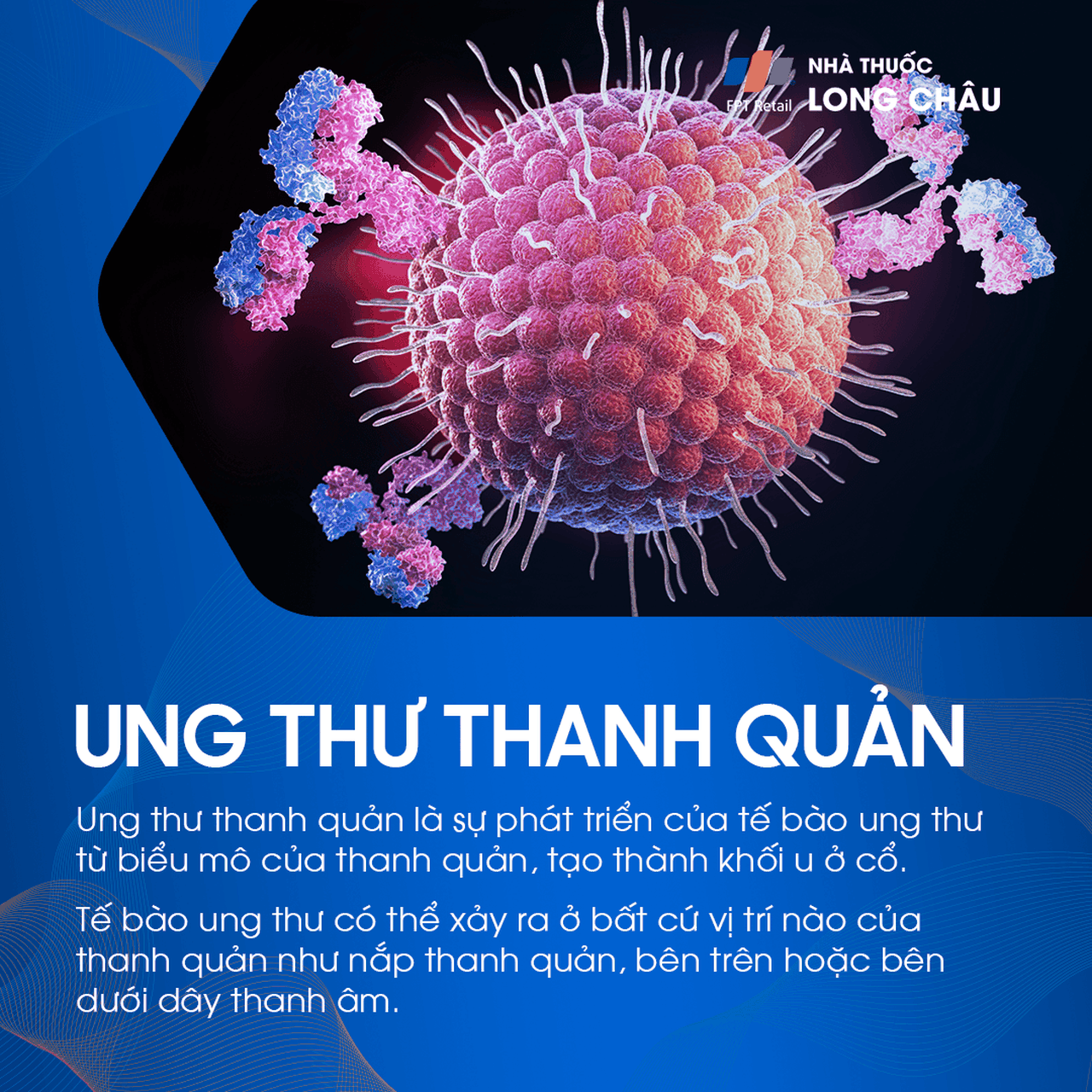 ung thư thanh quản 1