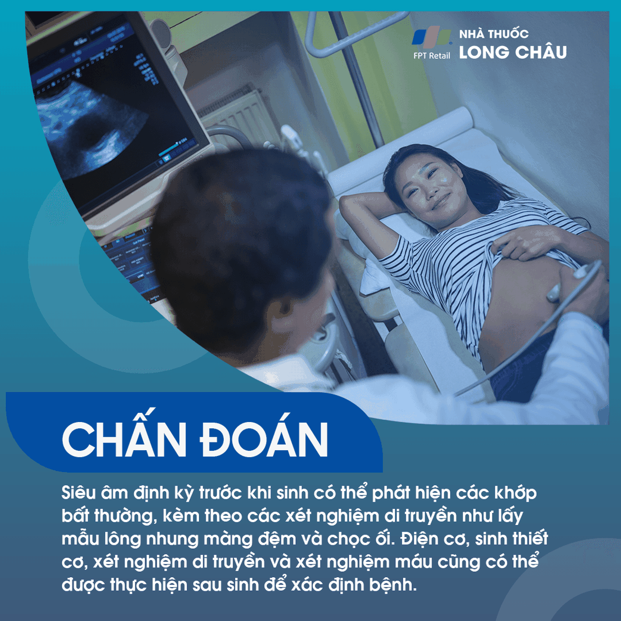 Cứng Đa Khớp Bẩm Sinh 5