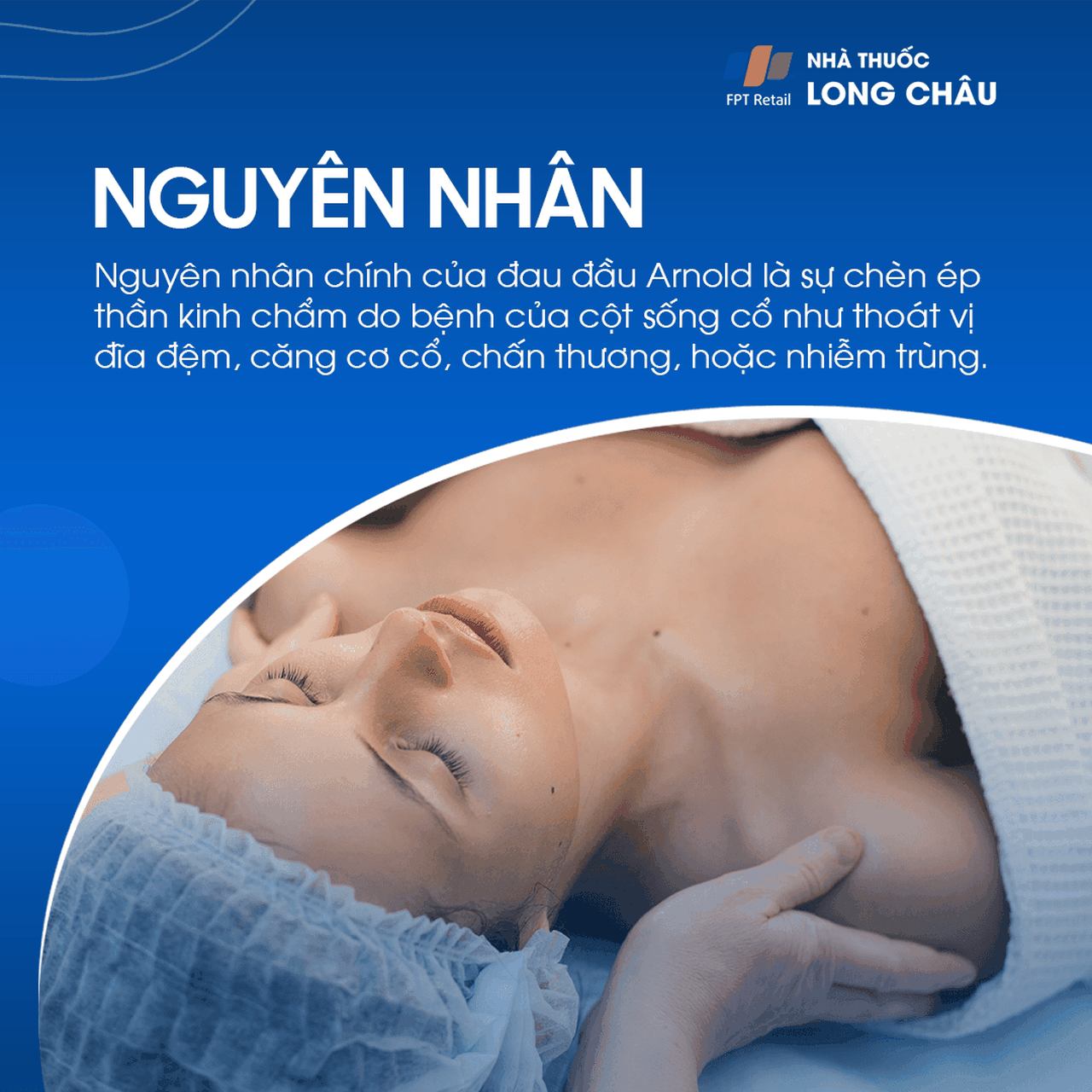 Đau đầu Arnold 3