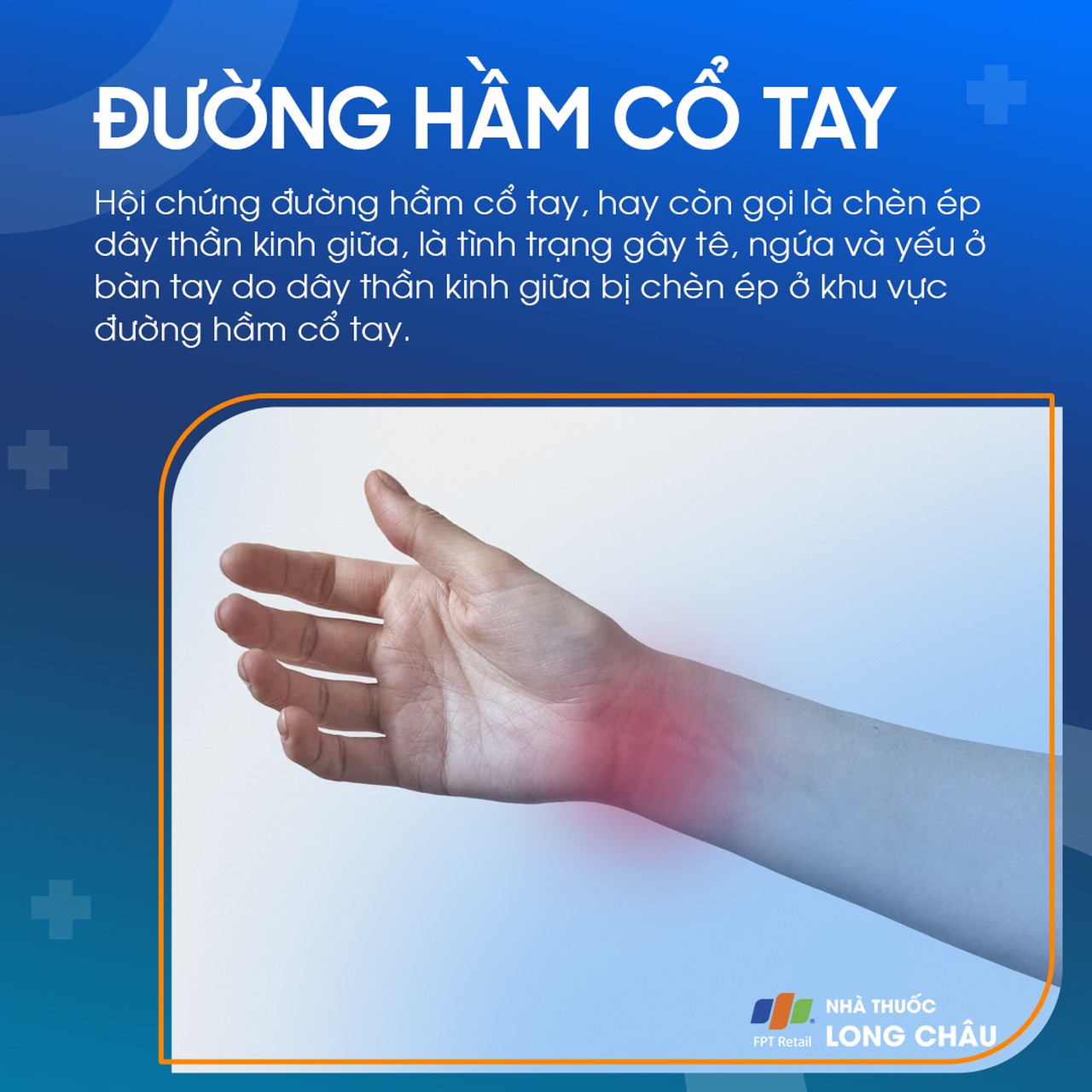 Đường Hầm Cổ Tay 1