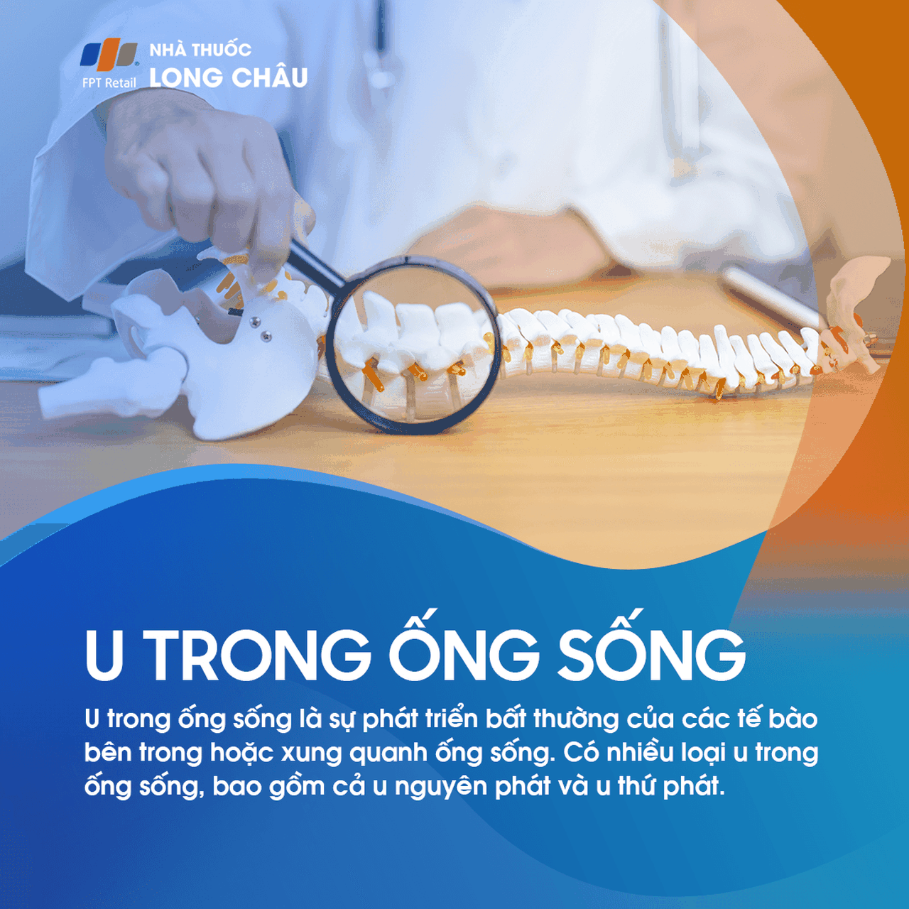 U Trong Ống Sống 1