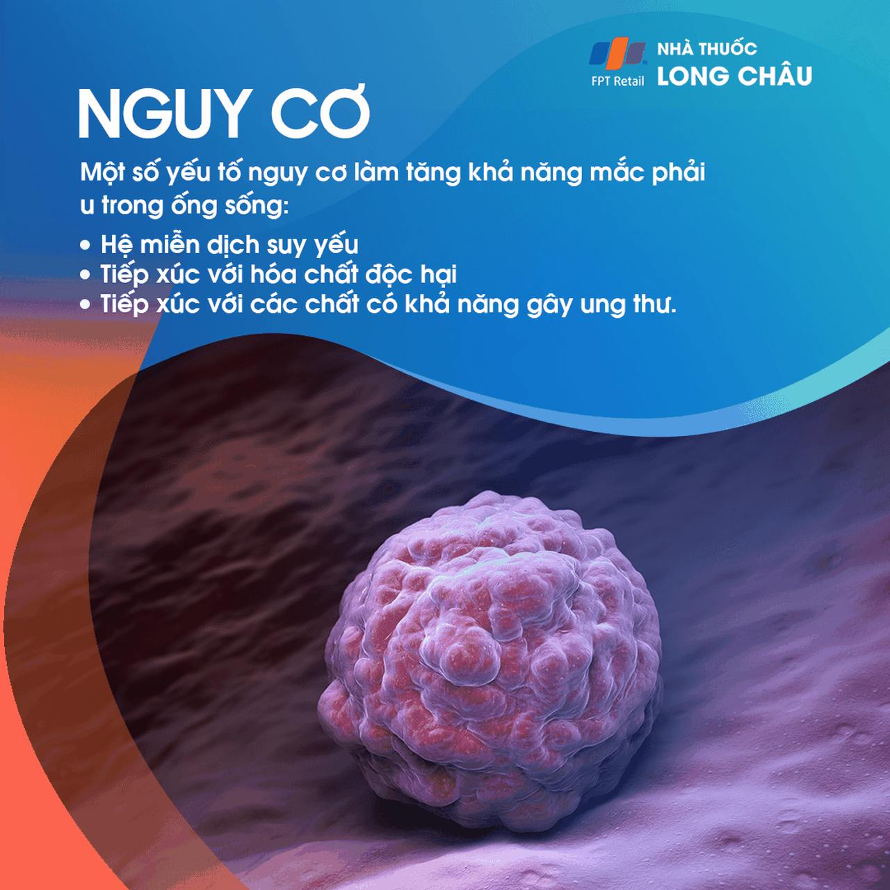 U Trong Ống Sống 4