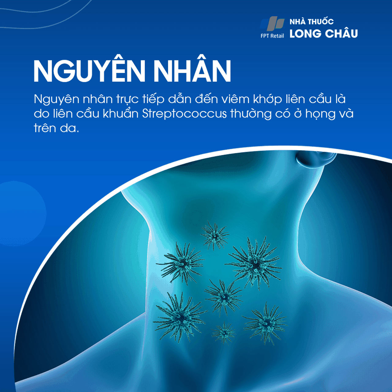 Viêm Khớp Liên Cầu 3