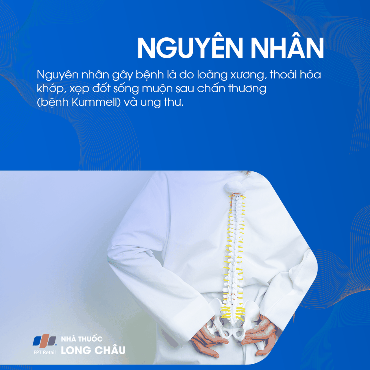 Xẹp Đốt Sống 3