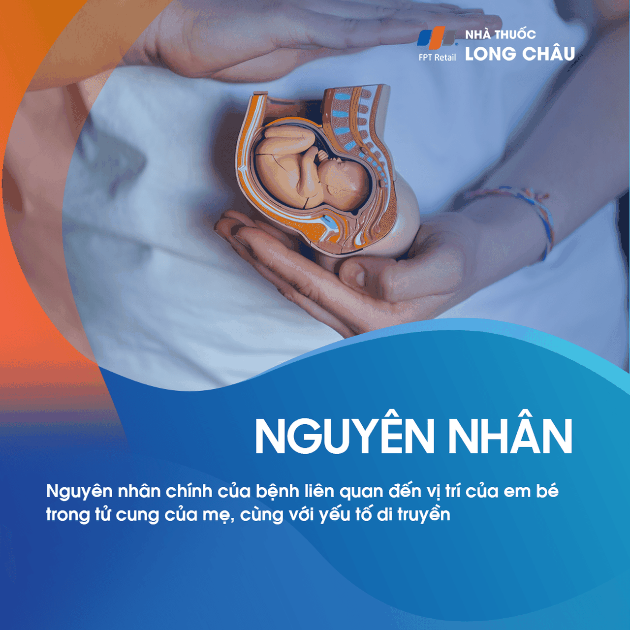 Xoắn Xương Đùi 3