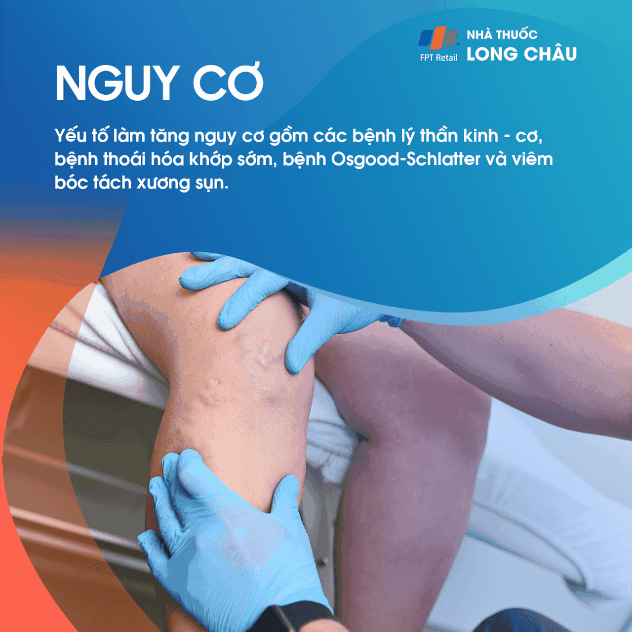 Xoắn Xương Đùi 4