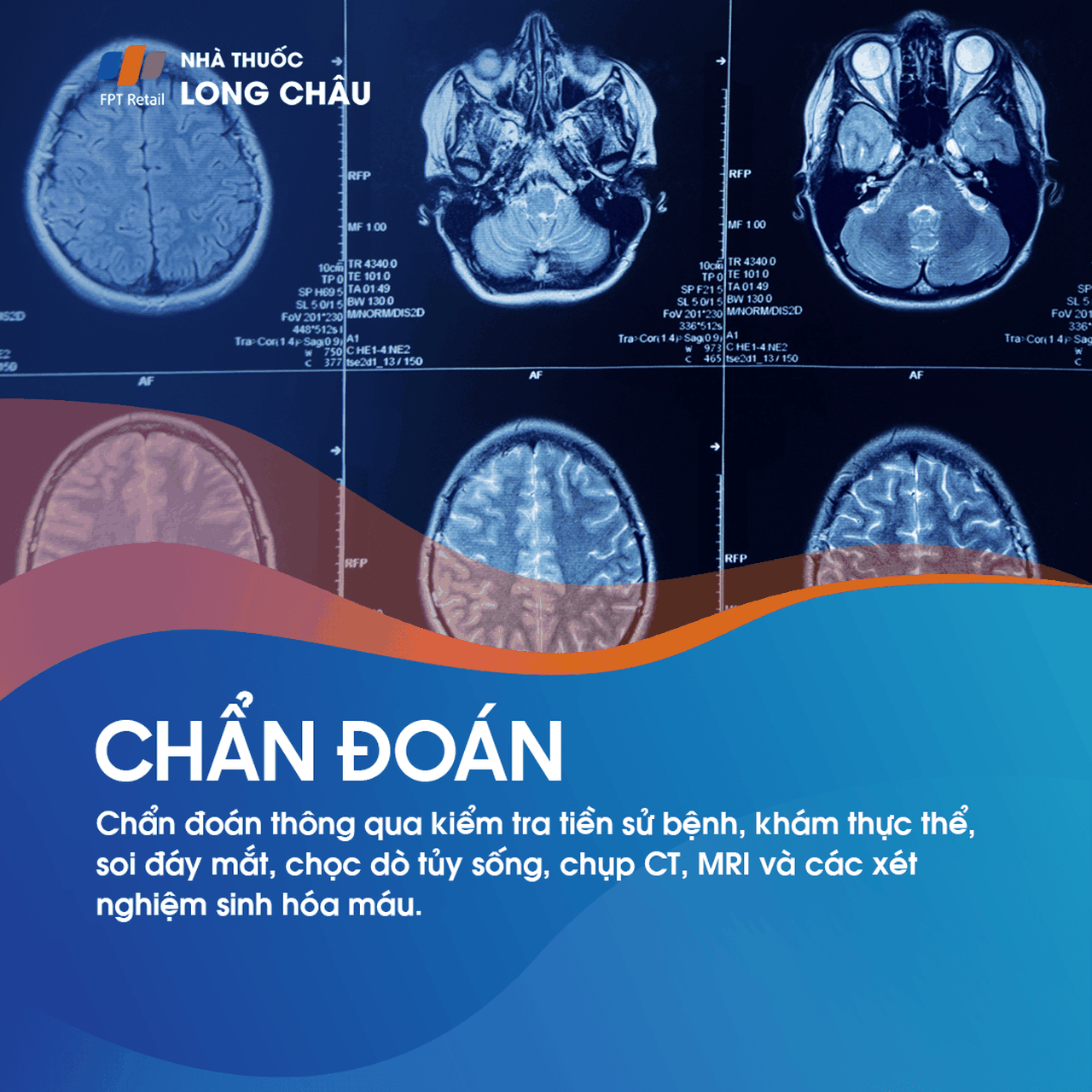 Áp lực nội sọ 6