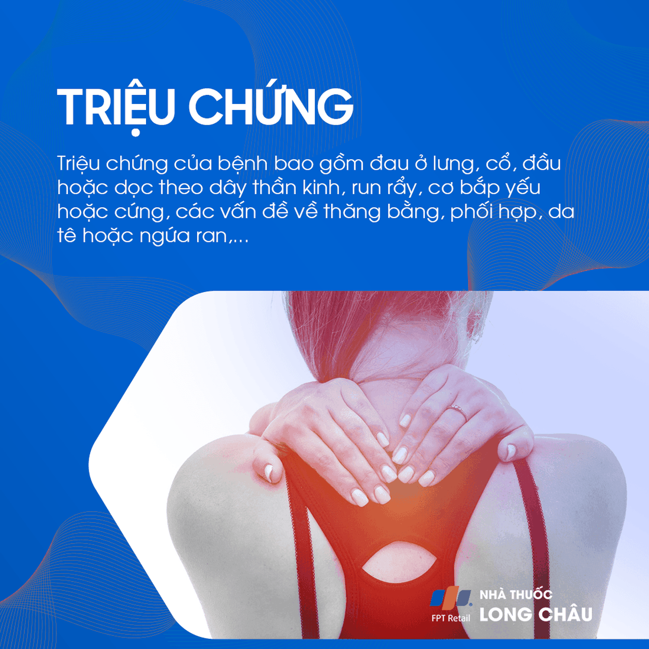 Bệnh thần kinh 2