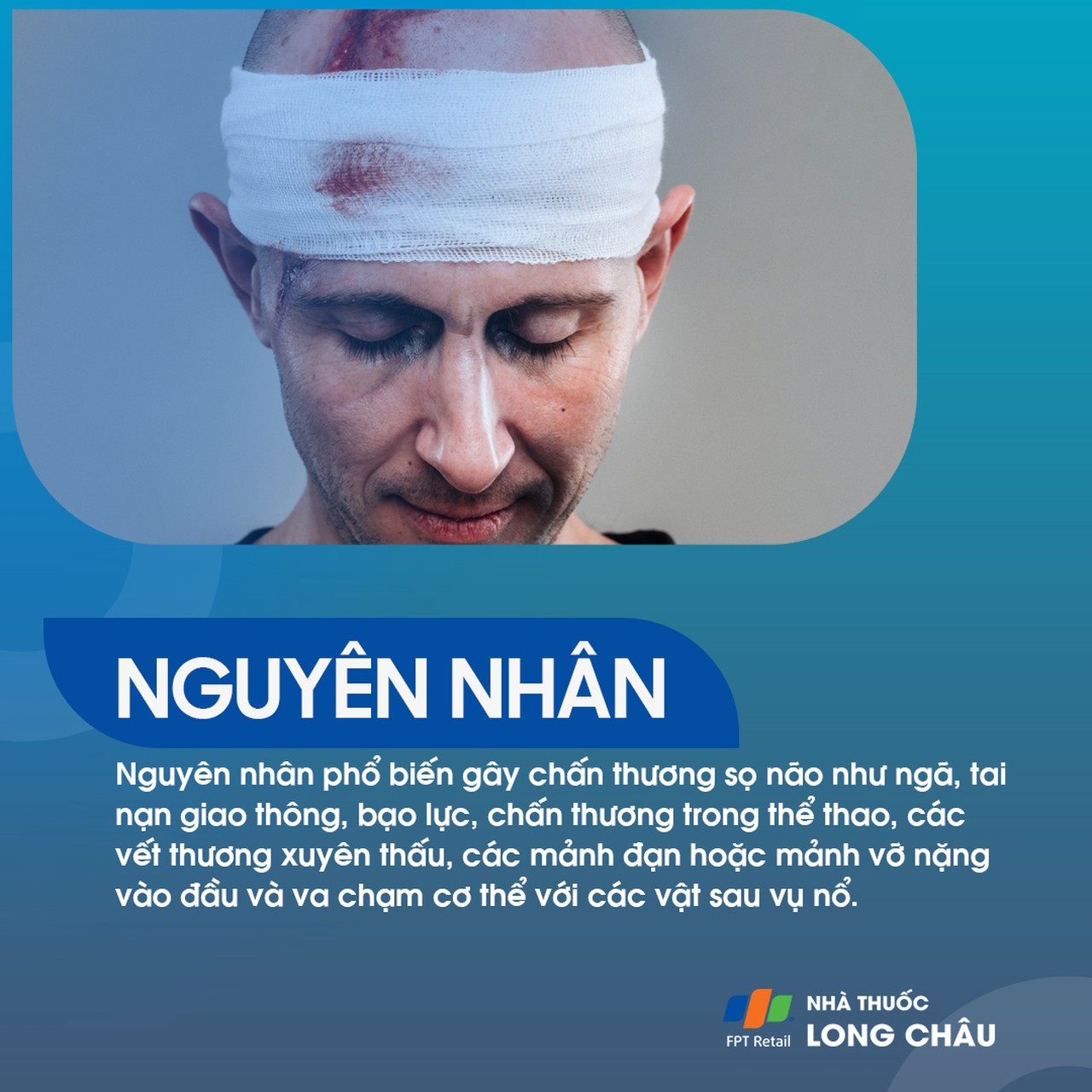 Té ngã, tai nạn, bạo lực hoặc vật sắc nhọn đâm xuyên có thể gây chấn thương sọ não