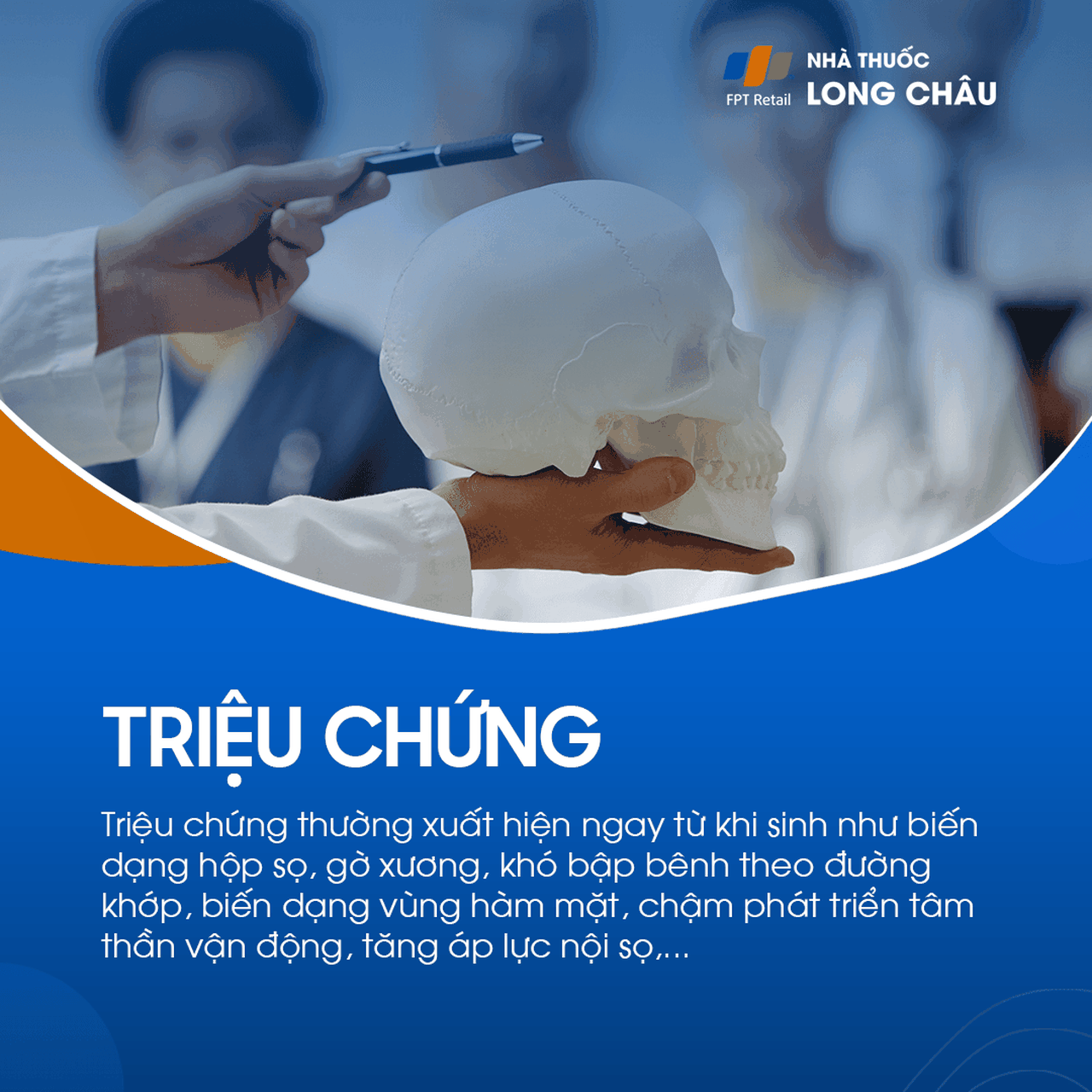 Chứng dính liền khớp sọ sớm 2