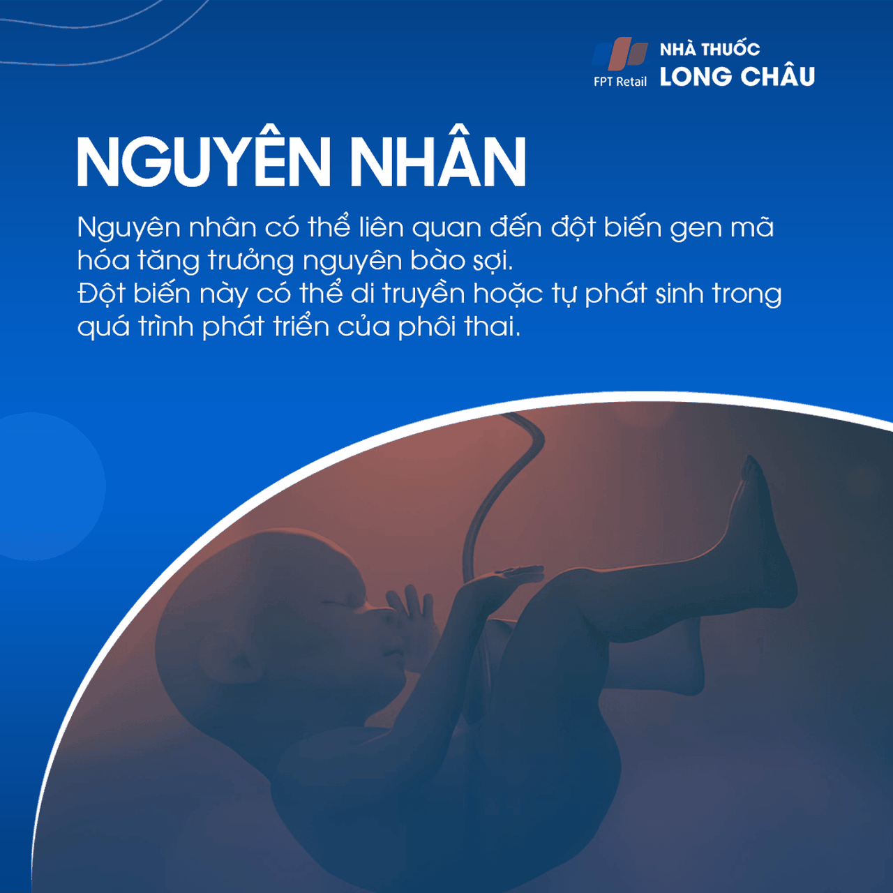 Chứng dính liền khớp sọ sớm 3