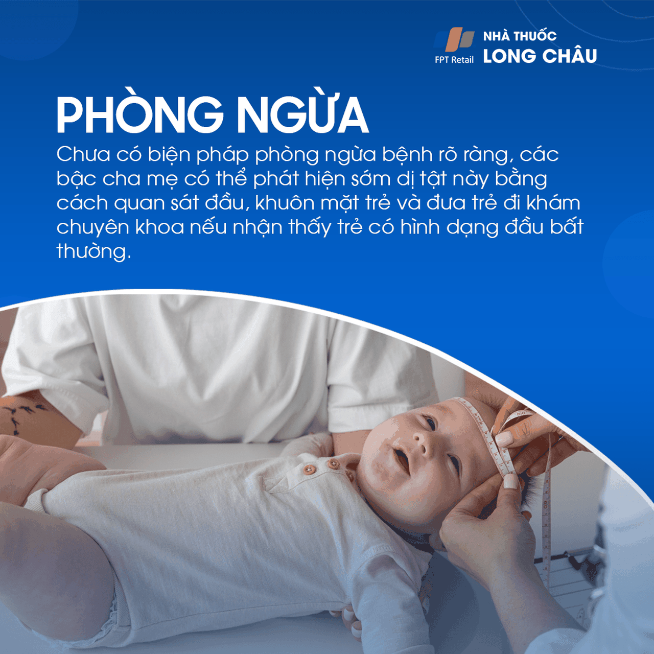 Chứng dính liền khớp sọ sớm 7