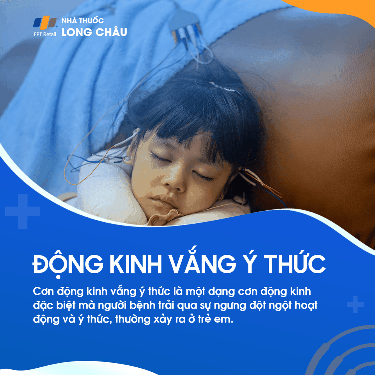 Cơn động kinh vắng ý thức 1