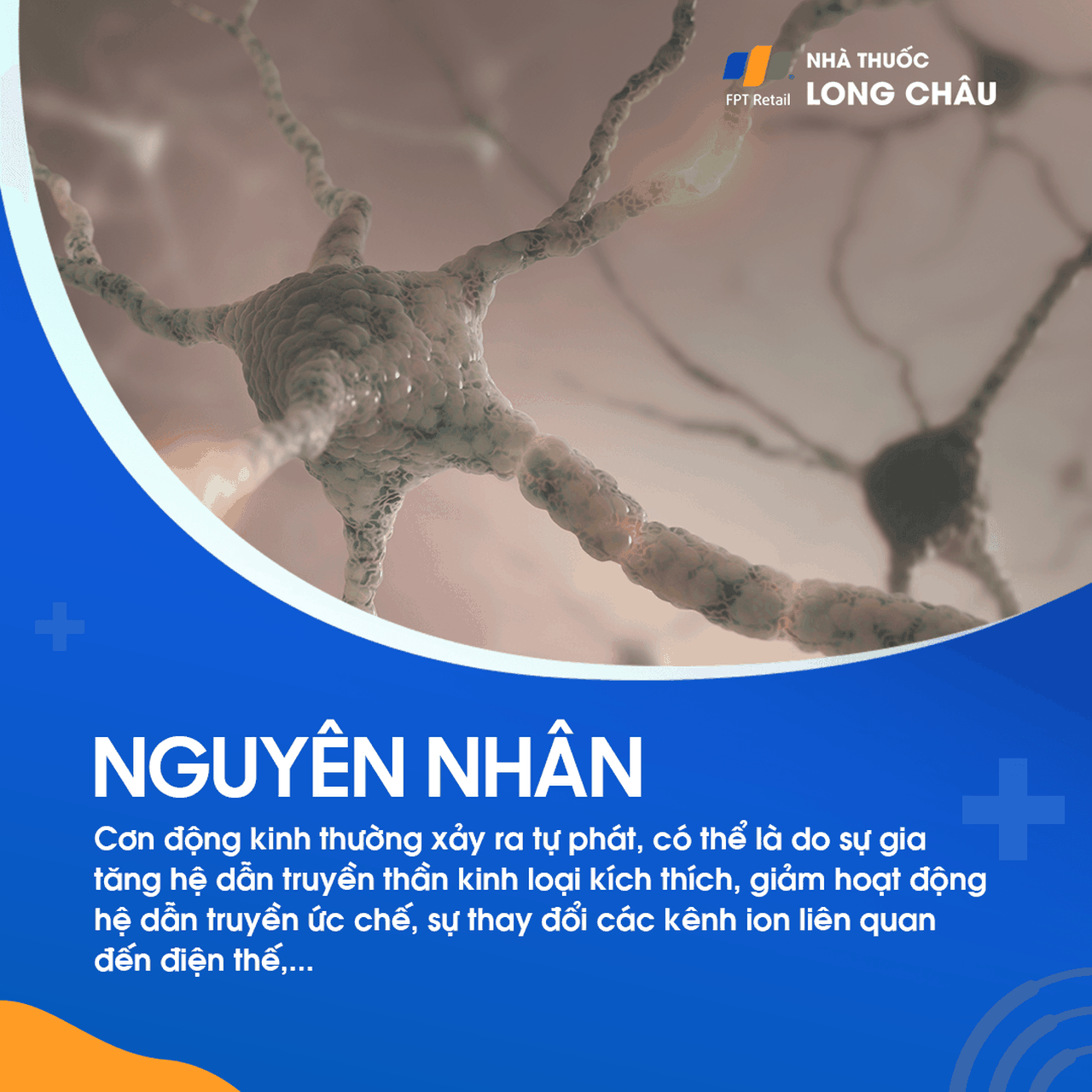 Cơn động kinh vắng ý thức 3