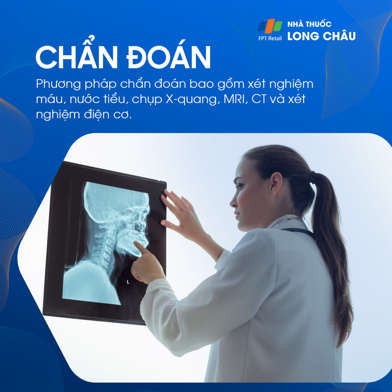Chẩn đoán đau cổ: Xét nghiệm máu, chụp X-quang, MRI, CT và điện cơ giúp xác định nguyên nhân đau cổ