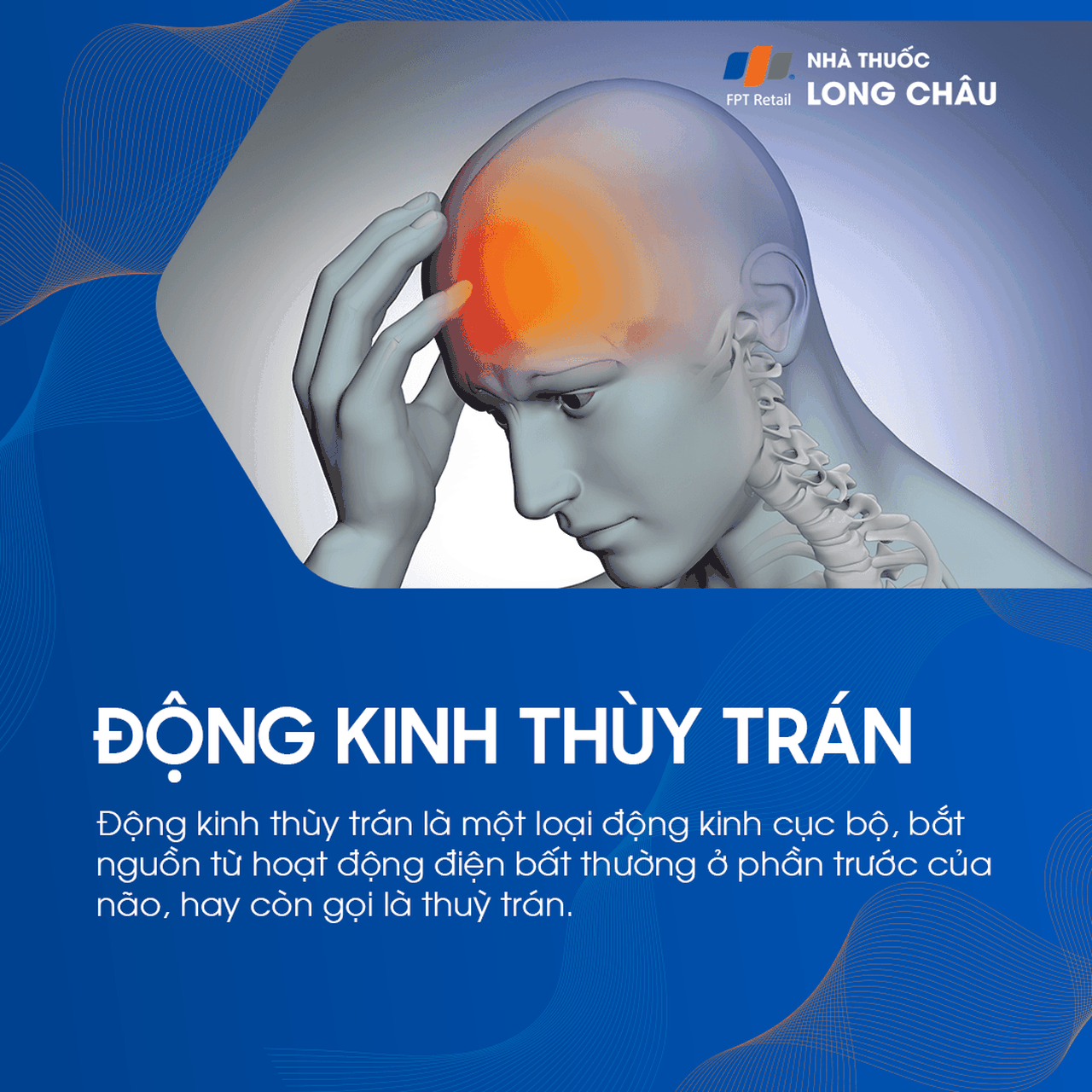 Động kinh thùy trán 1