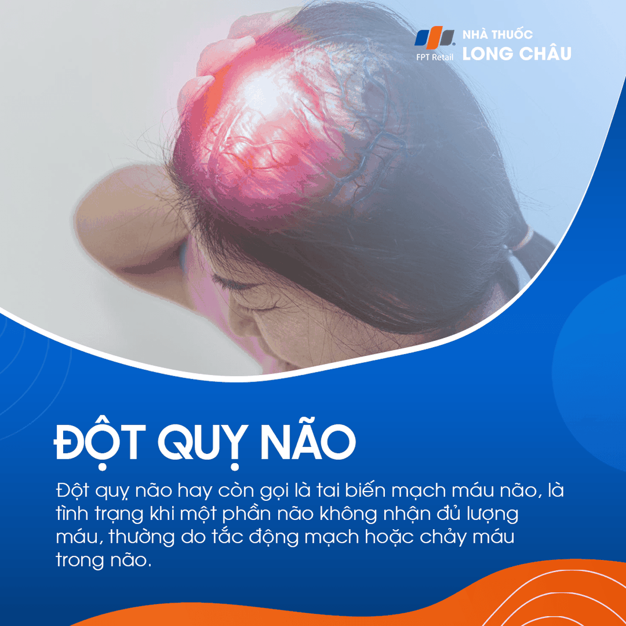 Đột quỵ não 1