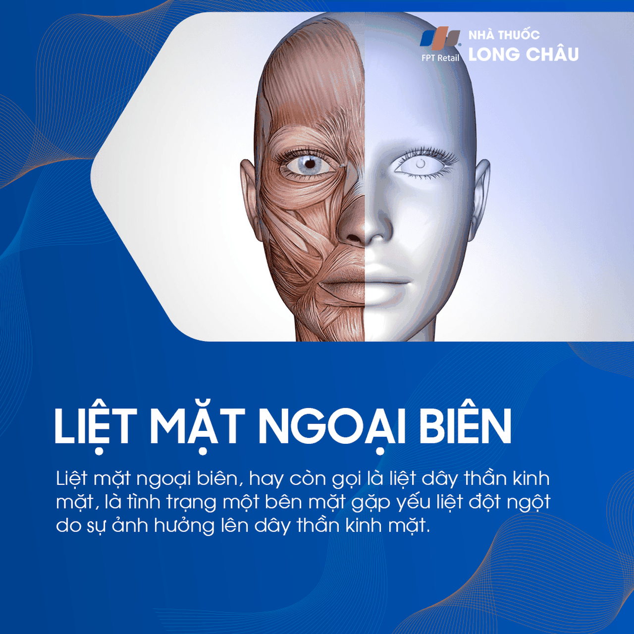 Liệt mặt ngoại biên 1