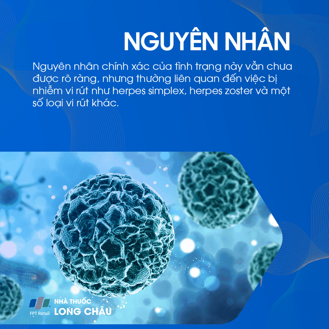 Liệt mặt ngoại biên 3