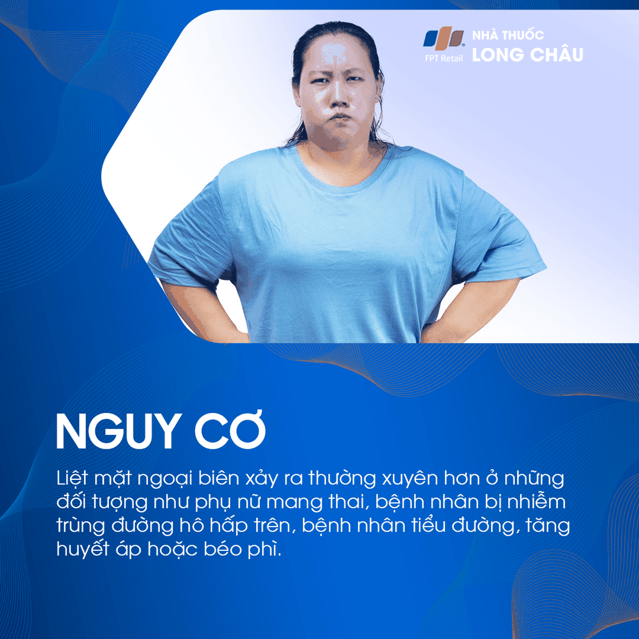 Liệt mặt ngoại biên 4