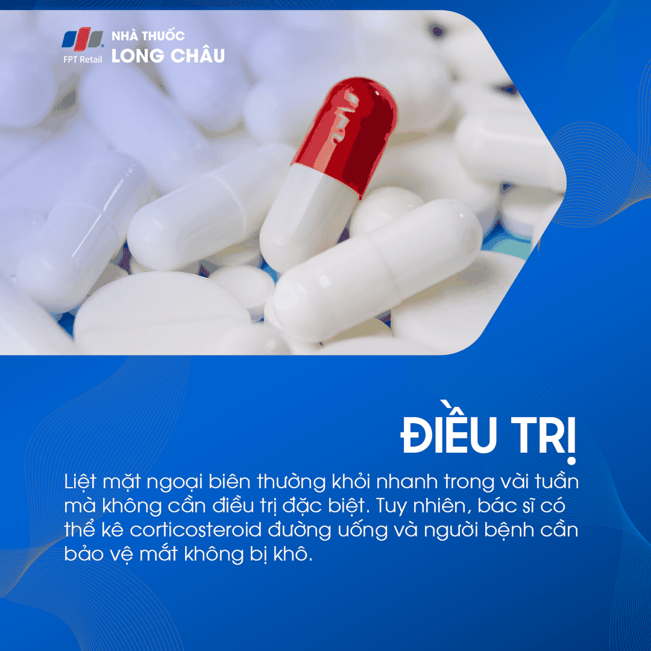 Liệt mặt ngoại biên 6