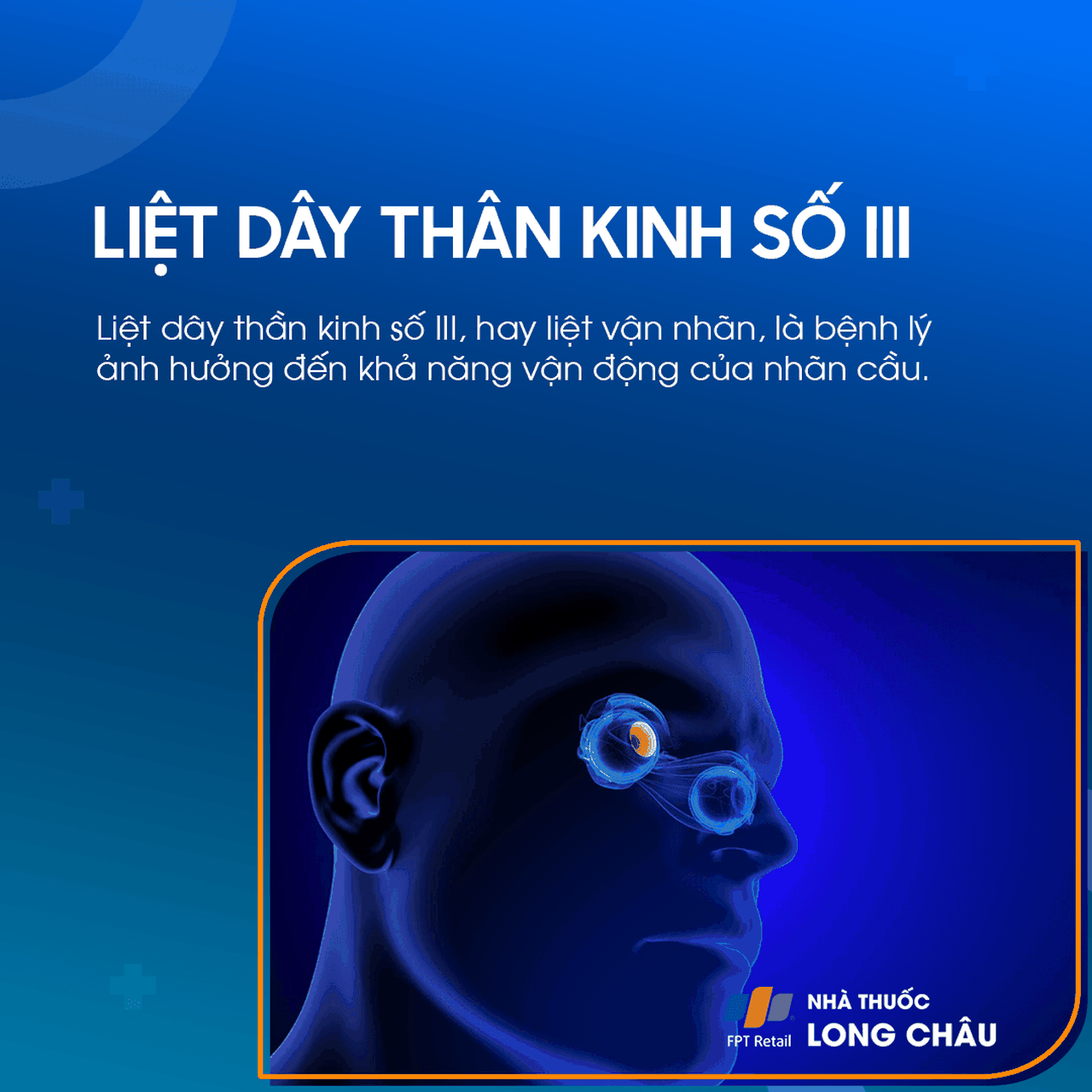 Liệt dây thần kinh số III 1