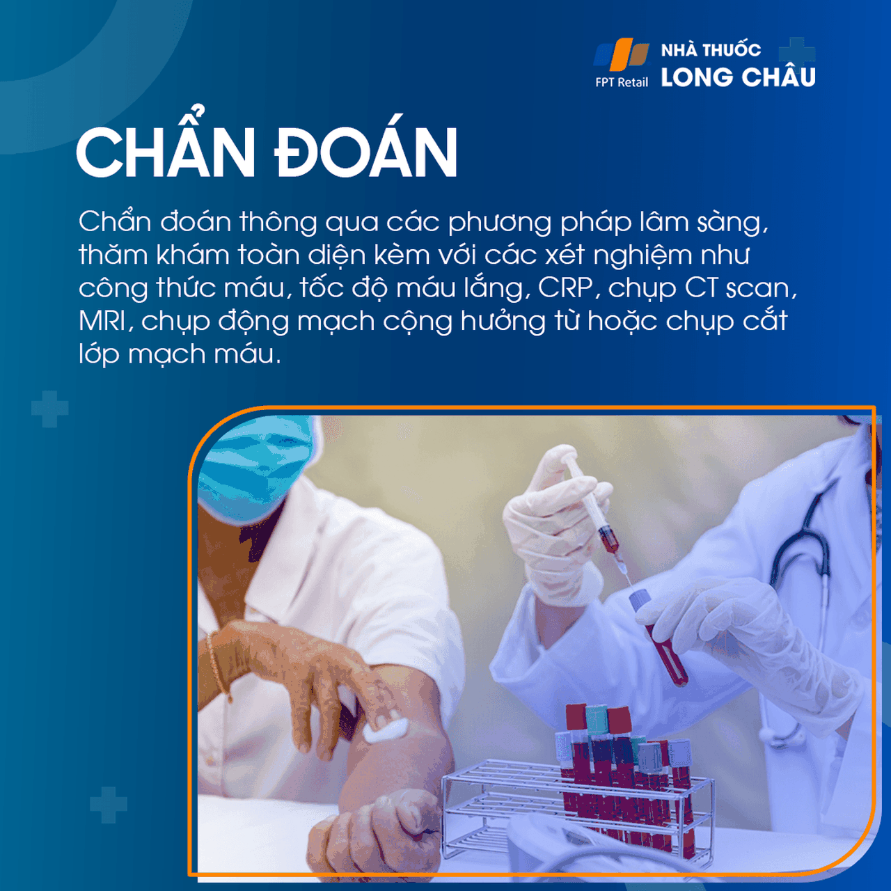 Liệt dây thần kinh số III 5