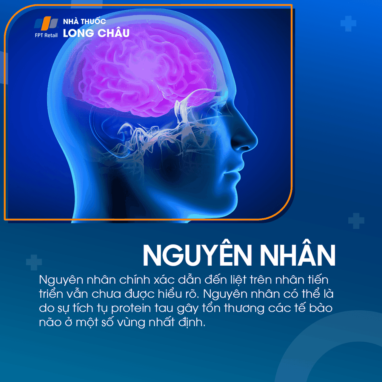 Liệt trên nhân tiến triển 3