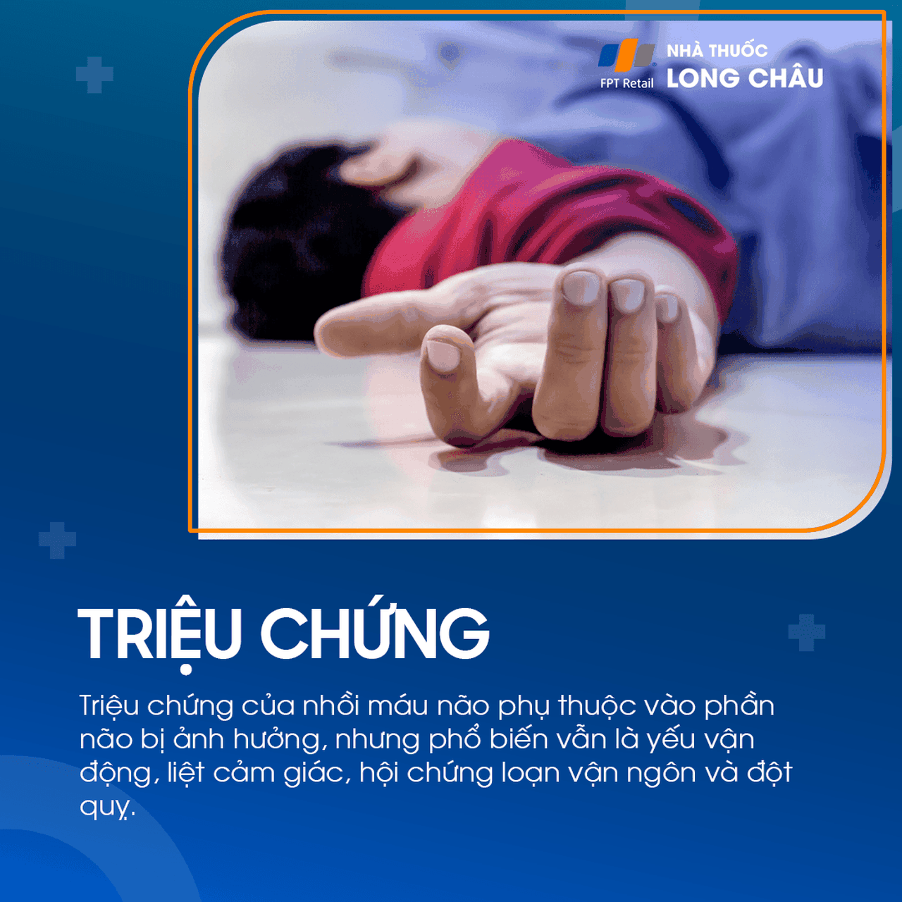 Đột quỵ não đang trải qua các triệu chứng như liệt nửa người và mất khả năng nói