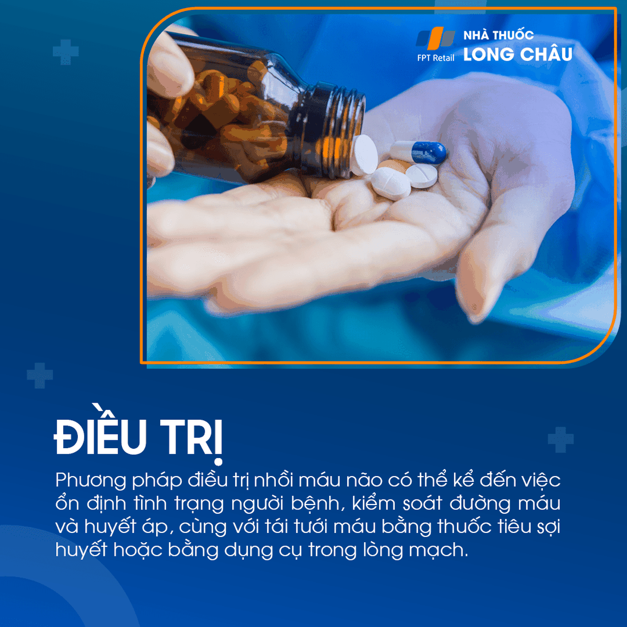 Điều trị nhồi máu não bằng thuốc tiêu cục máu đông và phục hồi chức năng