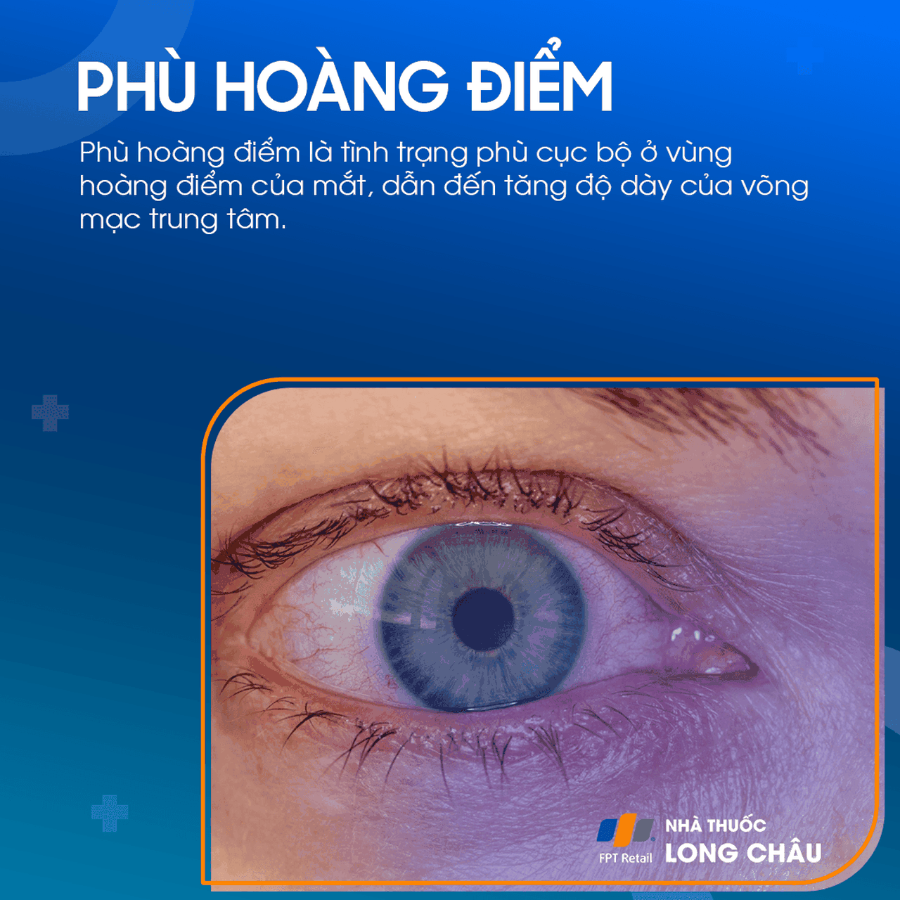 Phù hoàng điểm 1