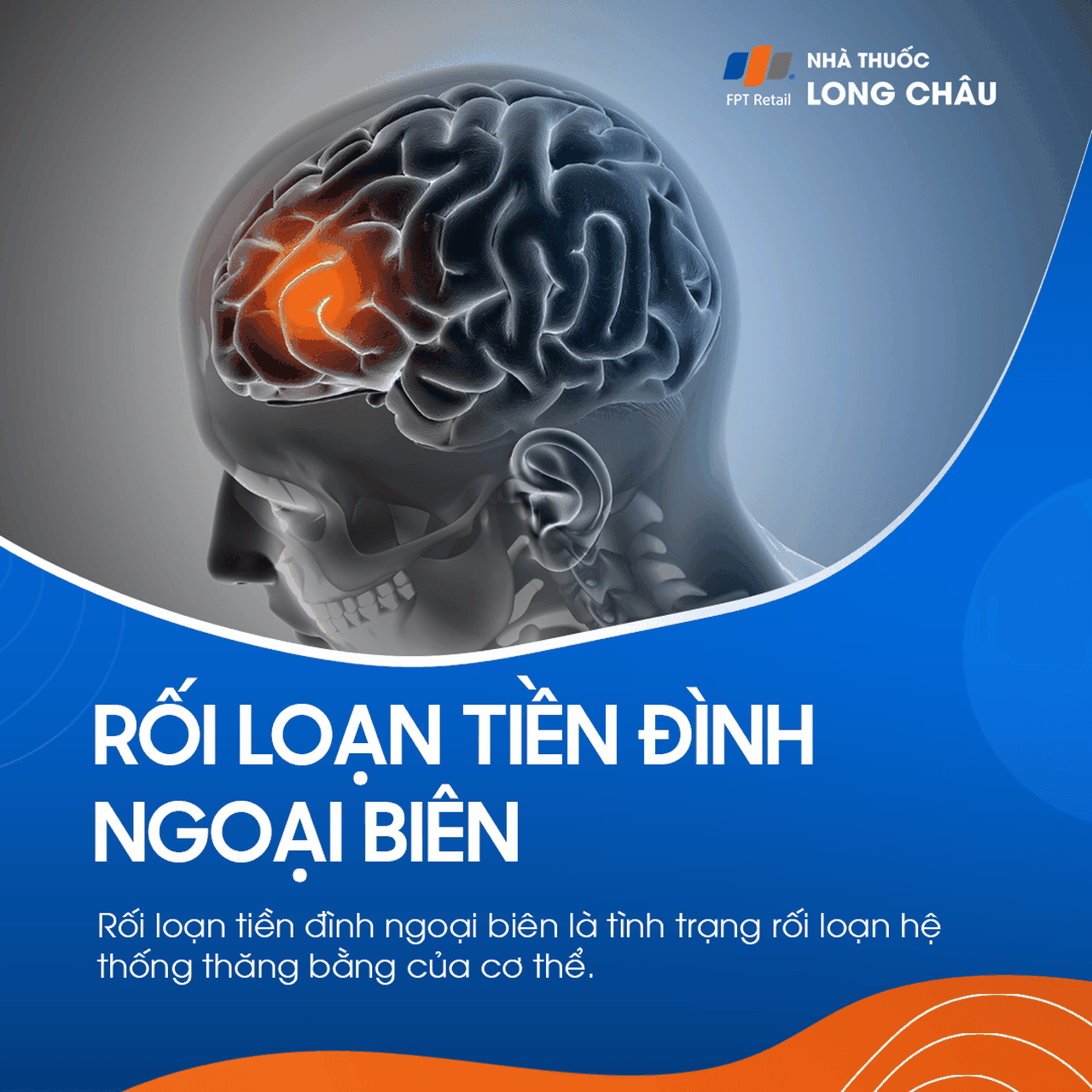 Rối loạn tiền đình ngoại biên 1
